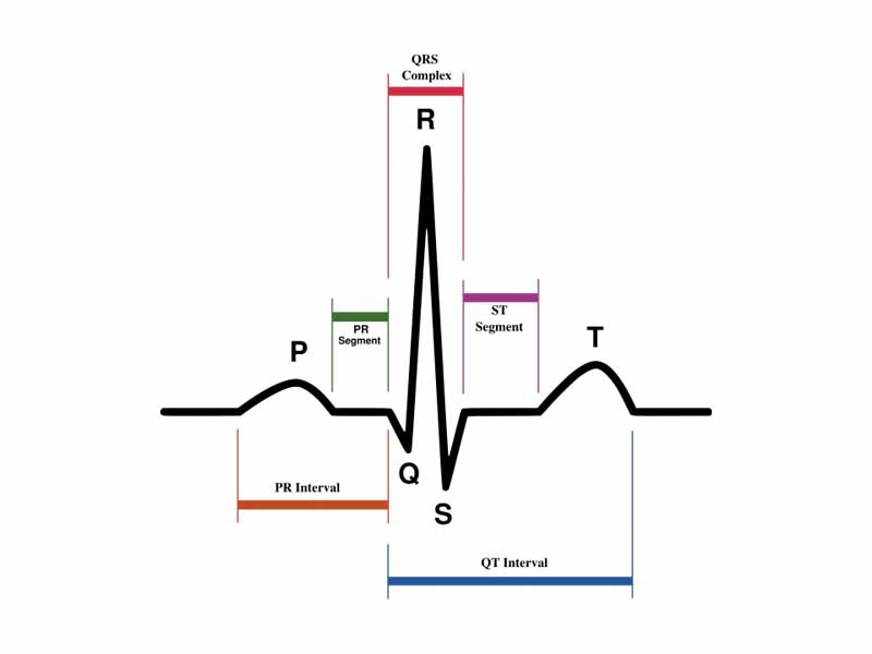 Schematic diagram of normal sinus rhythm for a human heart as seen on ECG.