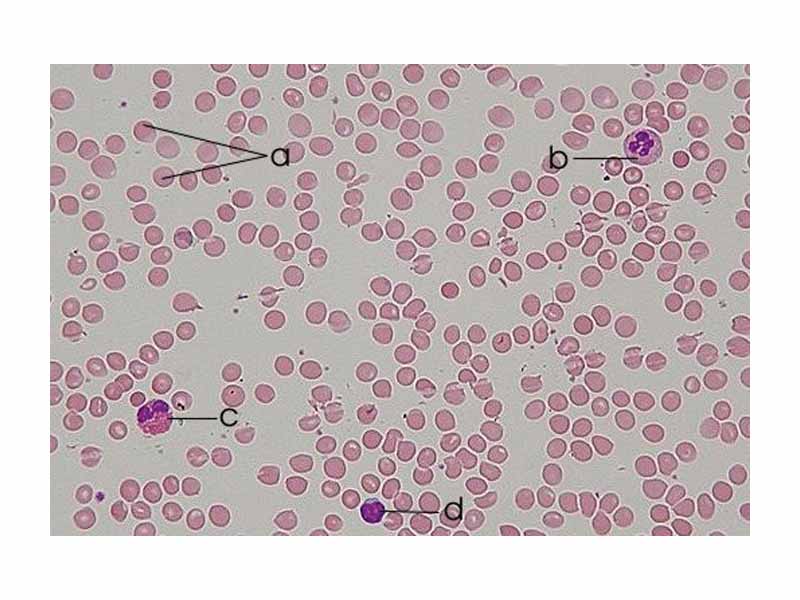 Human blood smear:  a - erythrocytes; b - neutrophil; c - eosinophil; d - lymphocyte.