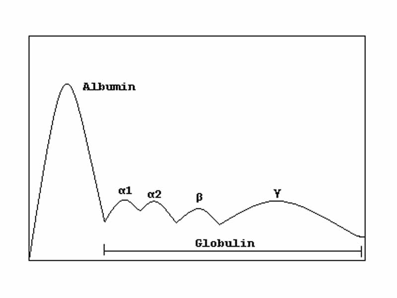 Electrophoresis of serum proteins