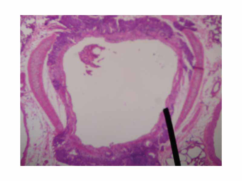 Cross sectional cut of a human secondary bronchus