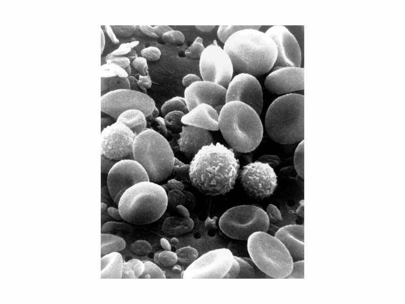 A scanning electron microscope image of normal circulating human blood. In addition to the irregularly shaped leukocytes, both red blood cells and many small disc-shaped platelets are visible