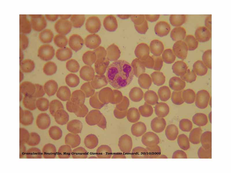 A blood smear showing a Neutrophil Granulocyte; the three-lobulated nucleus can be seen. This picture has been stained with MayGrunwald Giemsa, and observed with a 1000x objective in oil immersion.