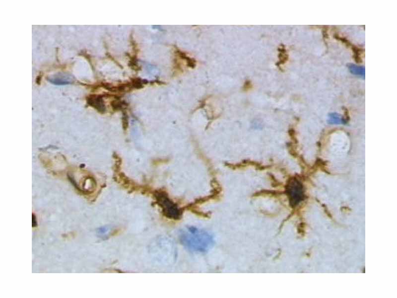 Microglia cells positive for lectins