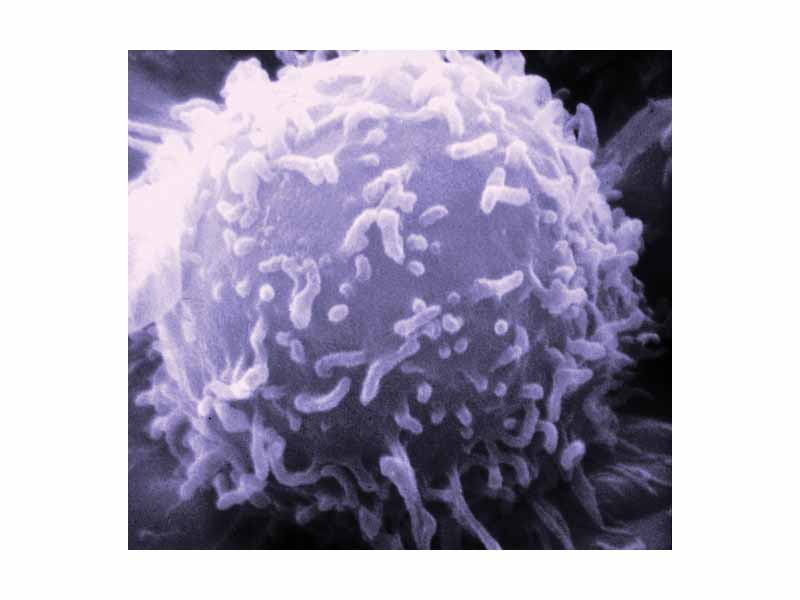A scanning electron microscope (SEM) image of a single human lymphocyte.