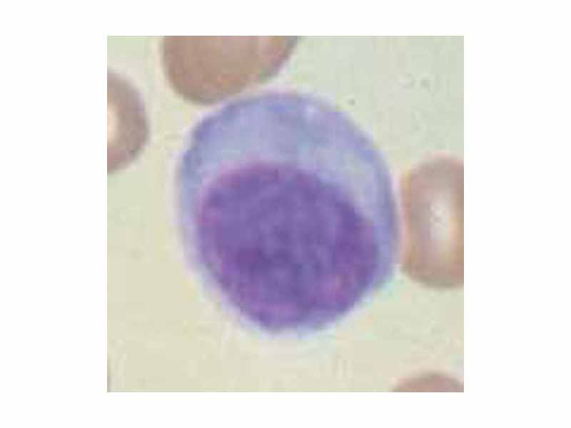 Plasma cell