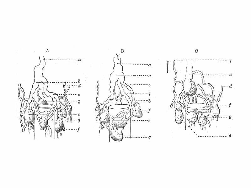 Modes of origin of thoracic duct. a. Thoracic duct. a’. Cisterna chyli. b, c’ Efferent trunks from lateral aortic glands. d. An efferent vessel which pierces the left crus of the diaphragm. e. f. Lateral aortic glands. h. Retroaortic glands. i. Intestinal trunk. j. Descending branch from intercostal lymphatics