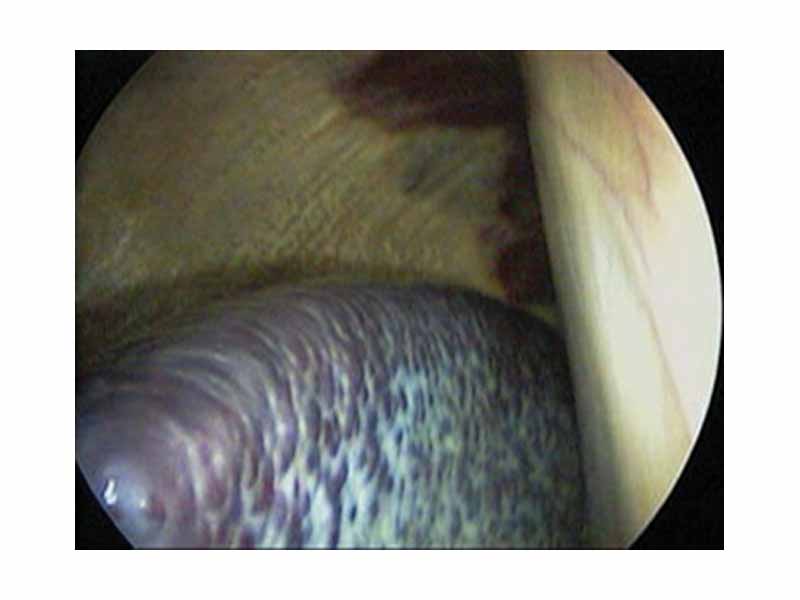 Laparoscopic view of a horse's spleen (the purple and grey mottled organ)