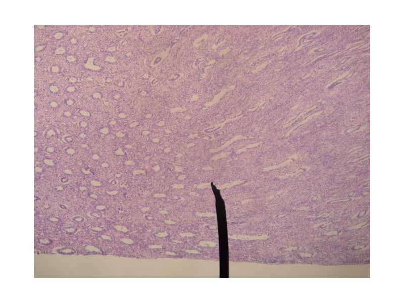 Microscopic cross section of the renal medulla.