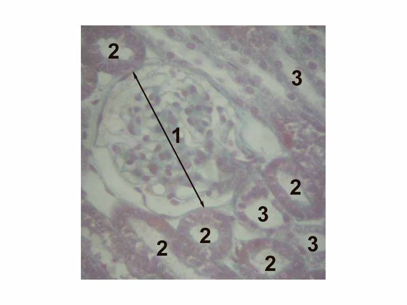 1 Glomerulus, 2 proximal tubule, 3 distal tubule