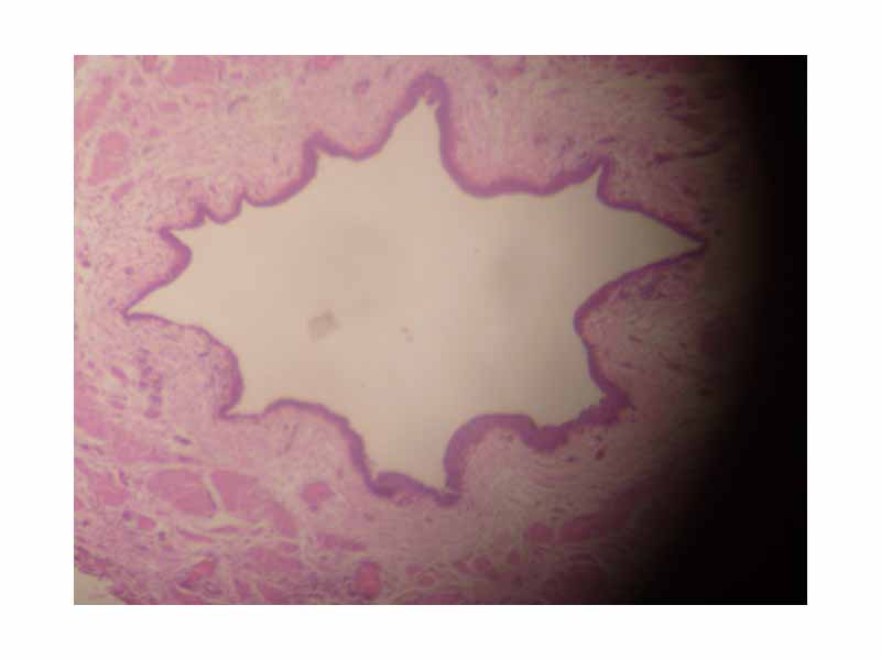 Cross section of ureter through a microscope.