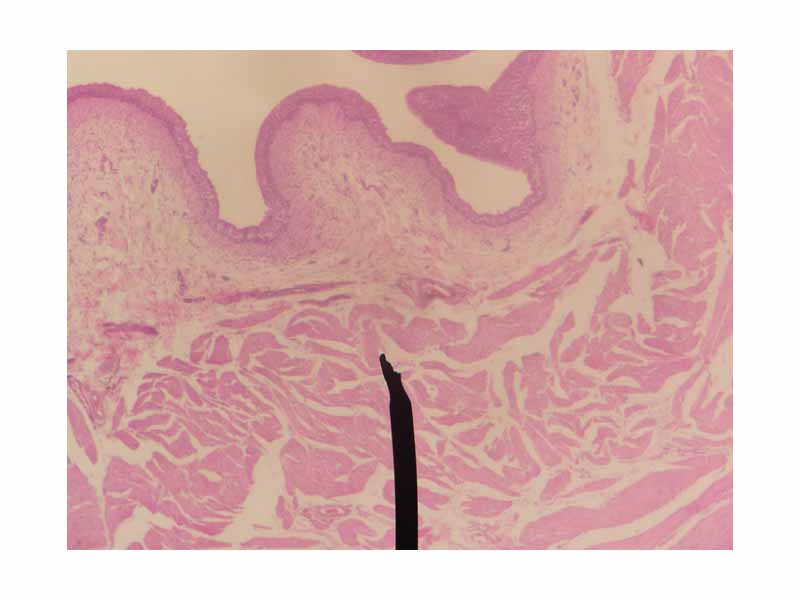 Layers of the urinary bladder wall and cross section of the detrusor muscle.