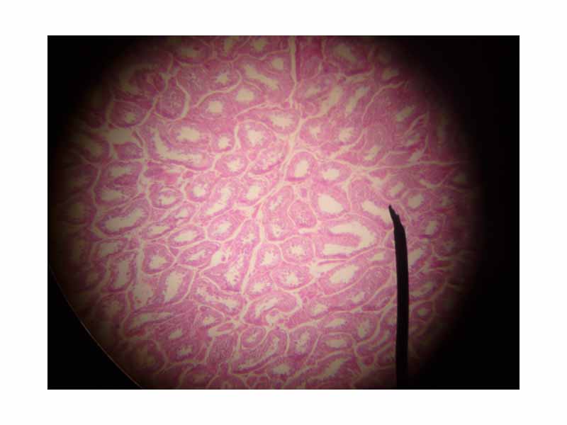 microscopic picture of seminiferous tubule (cross section)