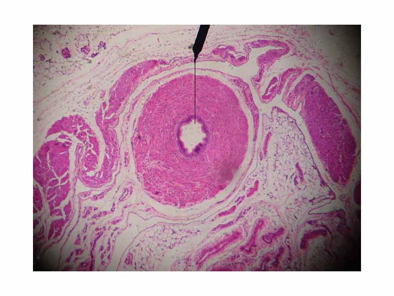 Cross-section of vas deferens through a microscope