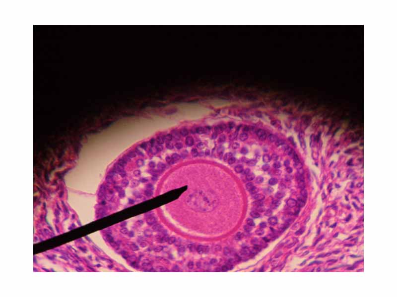 Human ovarian follicle