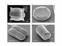 Scanning Electron micrographs of diat...