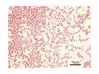 Gram-negative Pseudomonas aeruginosa ...