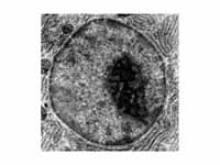 Micrograph of a cell nucleus publishe...