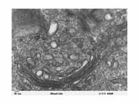 Micrograph of Golgi apparatus, visibl...