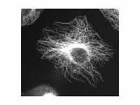 Microtubules in a gel fixated cell.