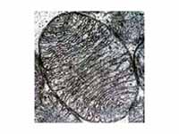 Electron micrograph of a single mitoc...