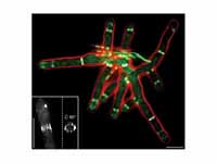 Septins in Ashbya gossypii (fluoresce...