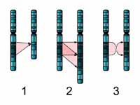 The three major single chromosome mut...