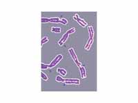 DNA damage resulting in multiple brok...