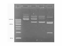 DNA agarose gel. The first lane conta...