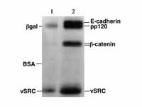 SDS-PAGE autoradiography. The indicat...