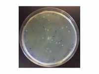 A LB agar plate showing the result of...