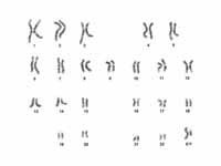 A karyotype of a human male, showing ...