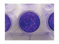 Viral Plaque Assay