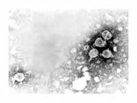 Micrograph showing hepatitis B virions
