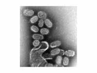 Micrograph of influenza virus