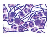 Gram-positive Bacillus anthracis bact...