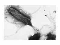 Electron micrograph of H. pylori poss...