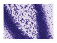 Image of a Nissl-stained histological...