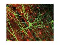 mage of pyramidal neurons in mouse ce...