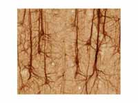 SMI32-stained pyramidal neurons in ce...