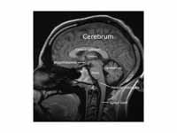 Sagittal slice from a MRI scan of a h...