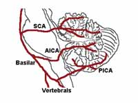 The three major arteries of the cereb...