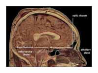 Location of the human hypothalamus