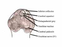 Transverse Section of the Brainstem a...