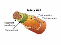 Schematic view of an artery