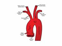 Plan of the branches of the aorta.