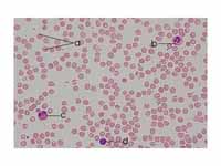 Human blood smear:  a - erythrocytes;...