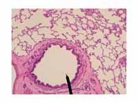 Cross sectional cut of terminal bronc...