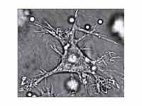 A dendritic cell