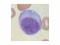 Plasma cell