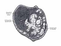 Section of small lymph gland of rabbi...